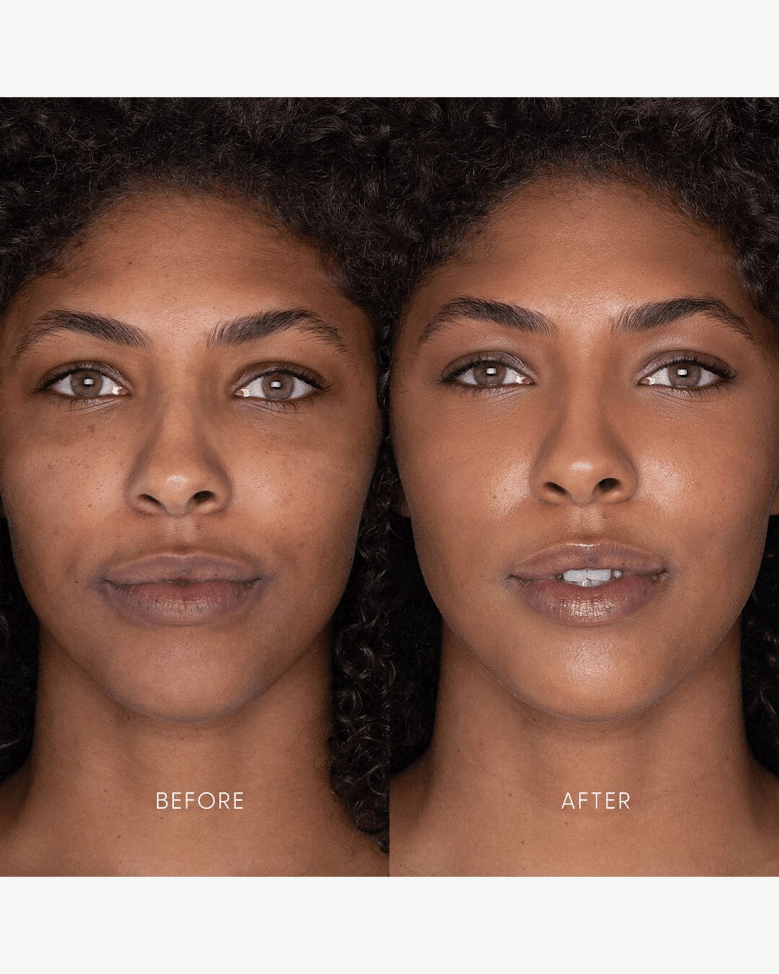 Best Skin Days Treatment Concealer