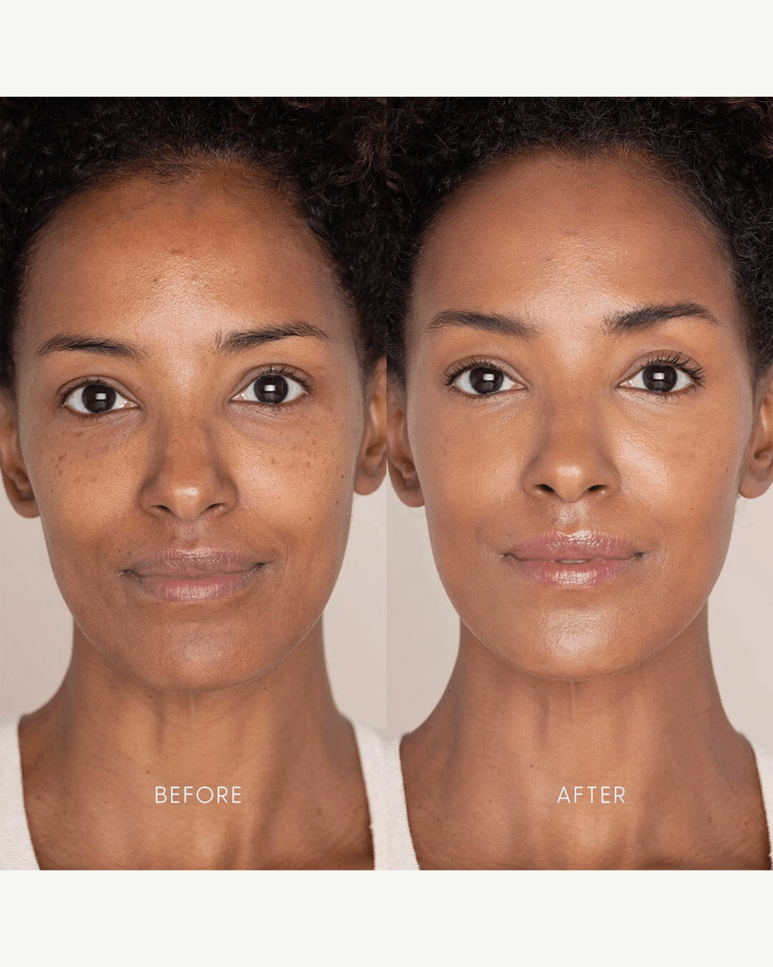 Best Skin Days Treatment Concealer