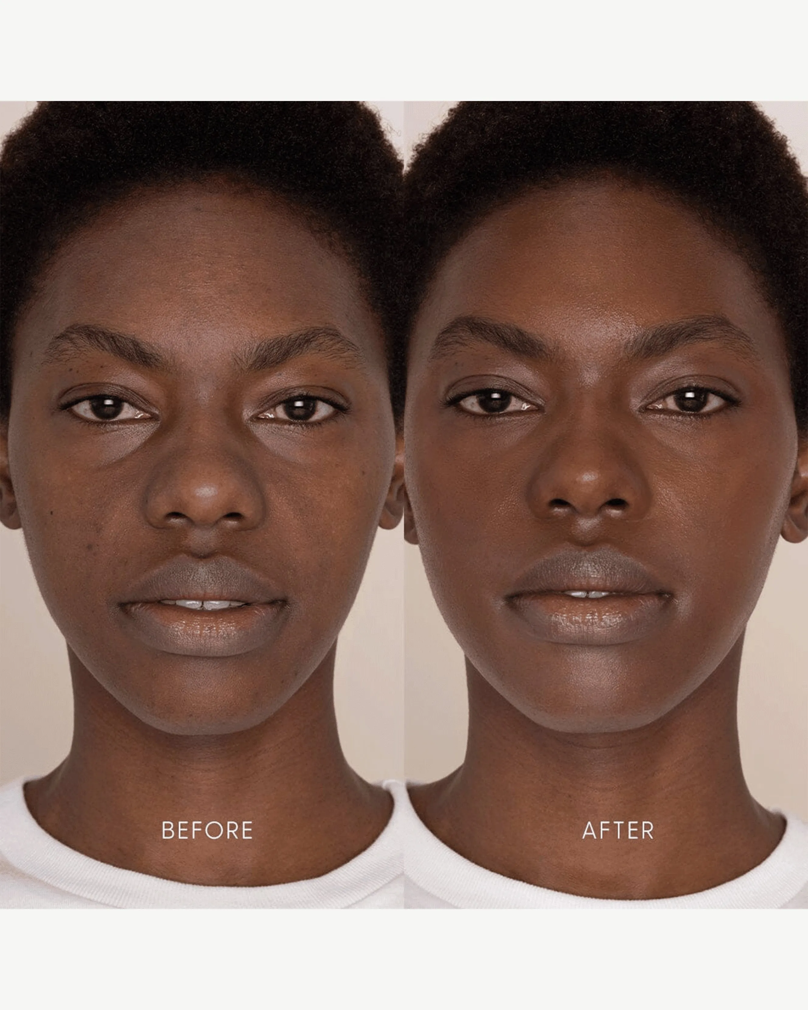 Best Skin Days Treatment Concealer
