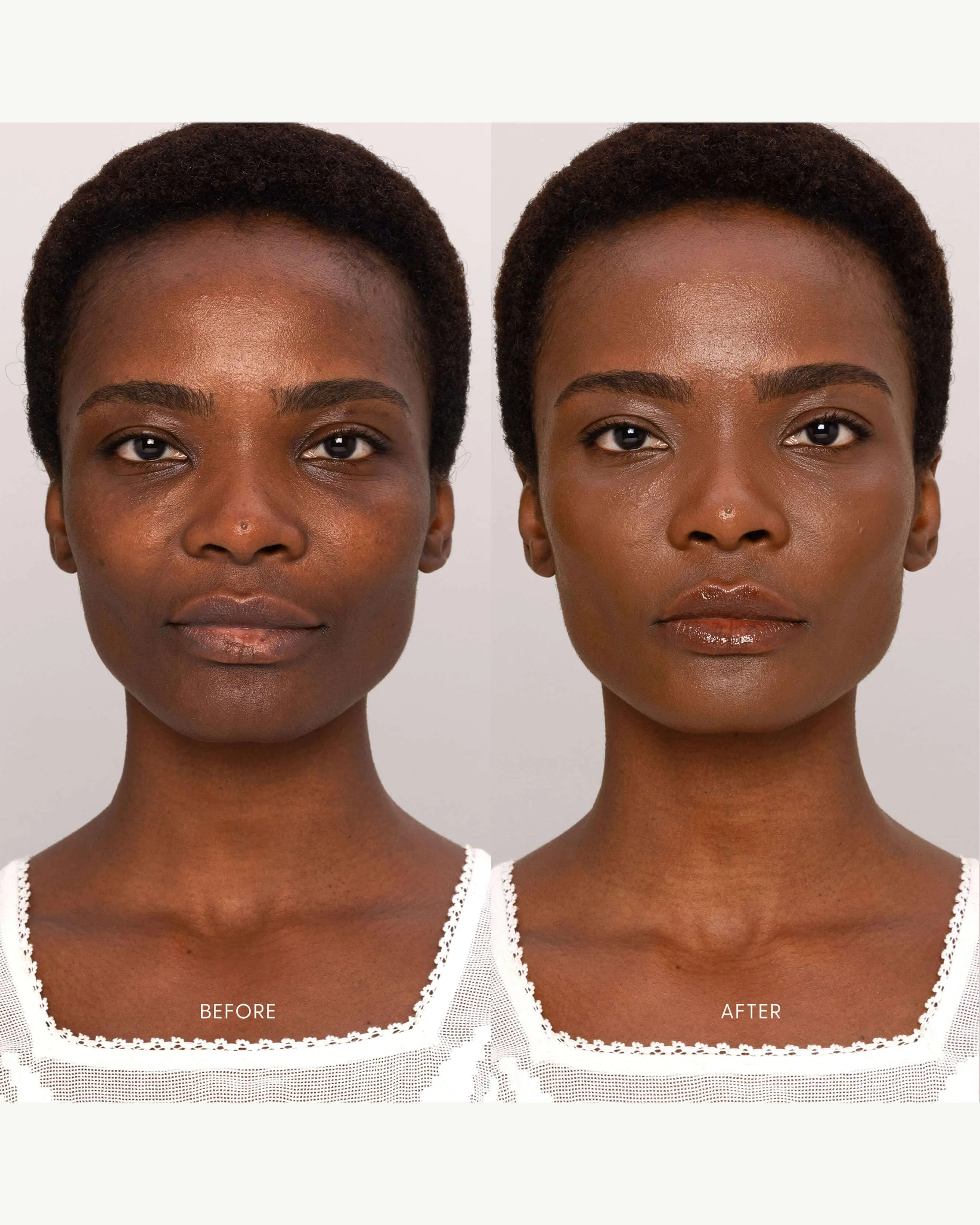Best Skin Days Treatment Concealer