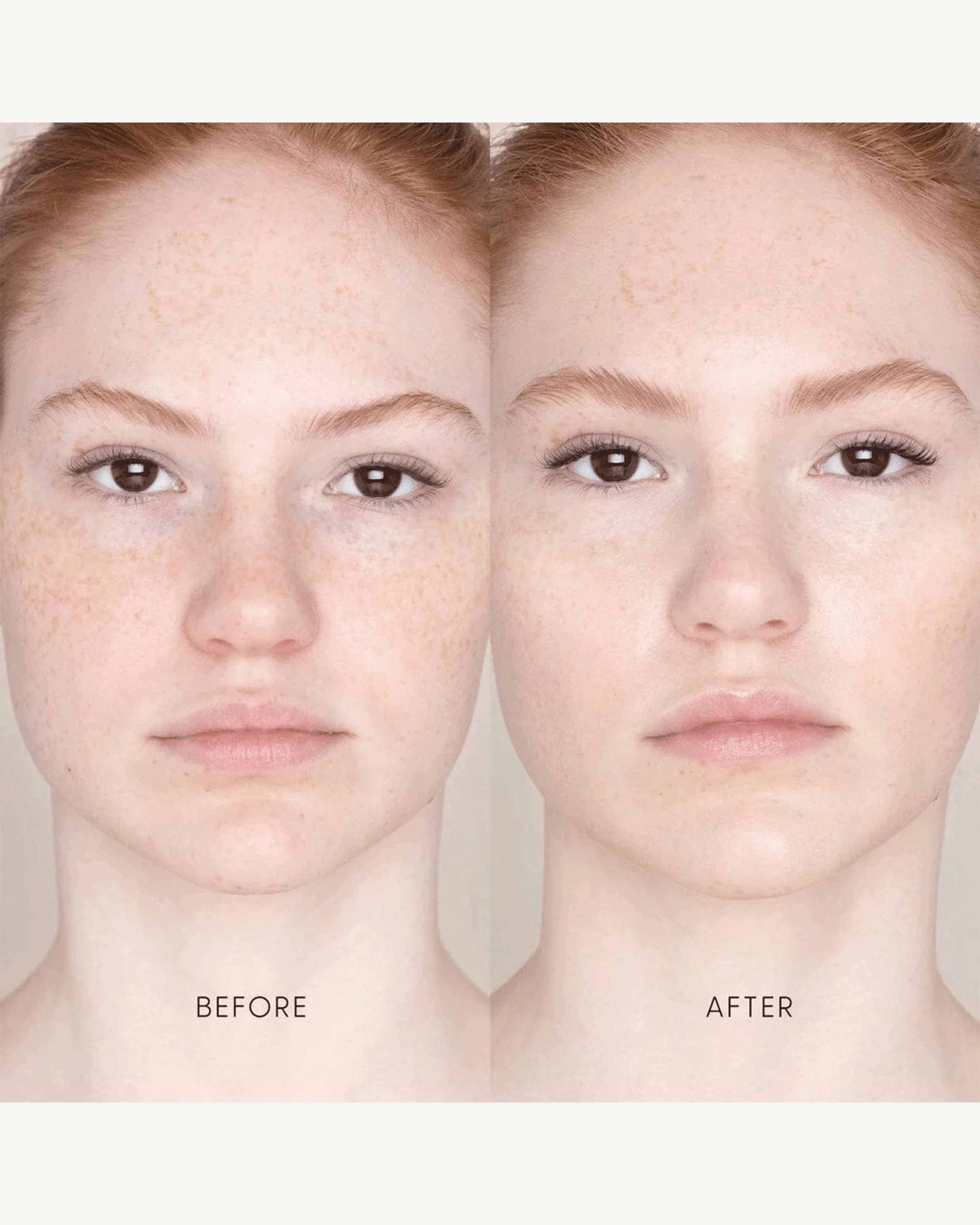 Best Skin Days Treatment Concealer
