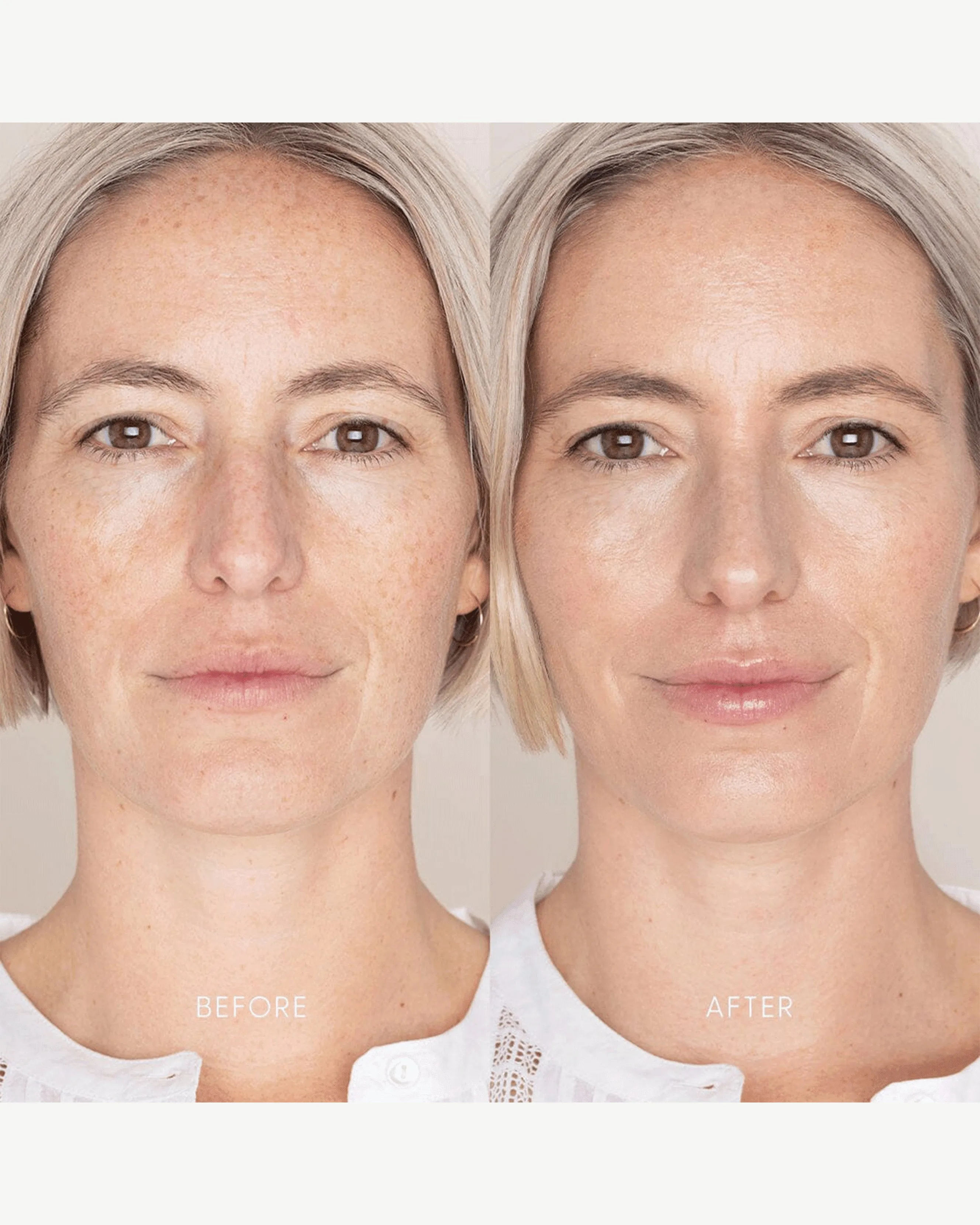 Best Skin Days Treatment Concealer