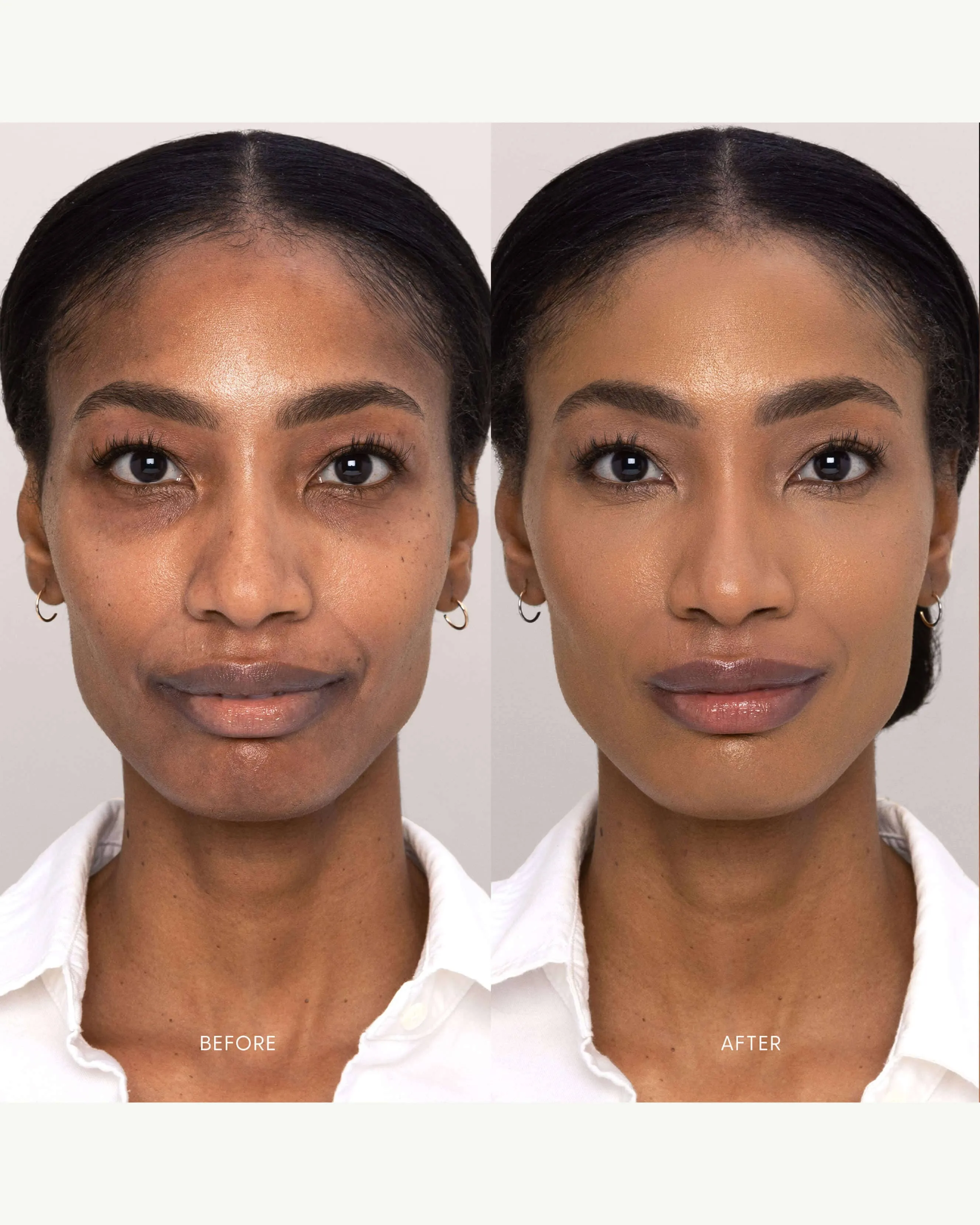Best Skin Days Treatment Concealer
