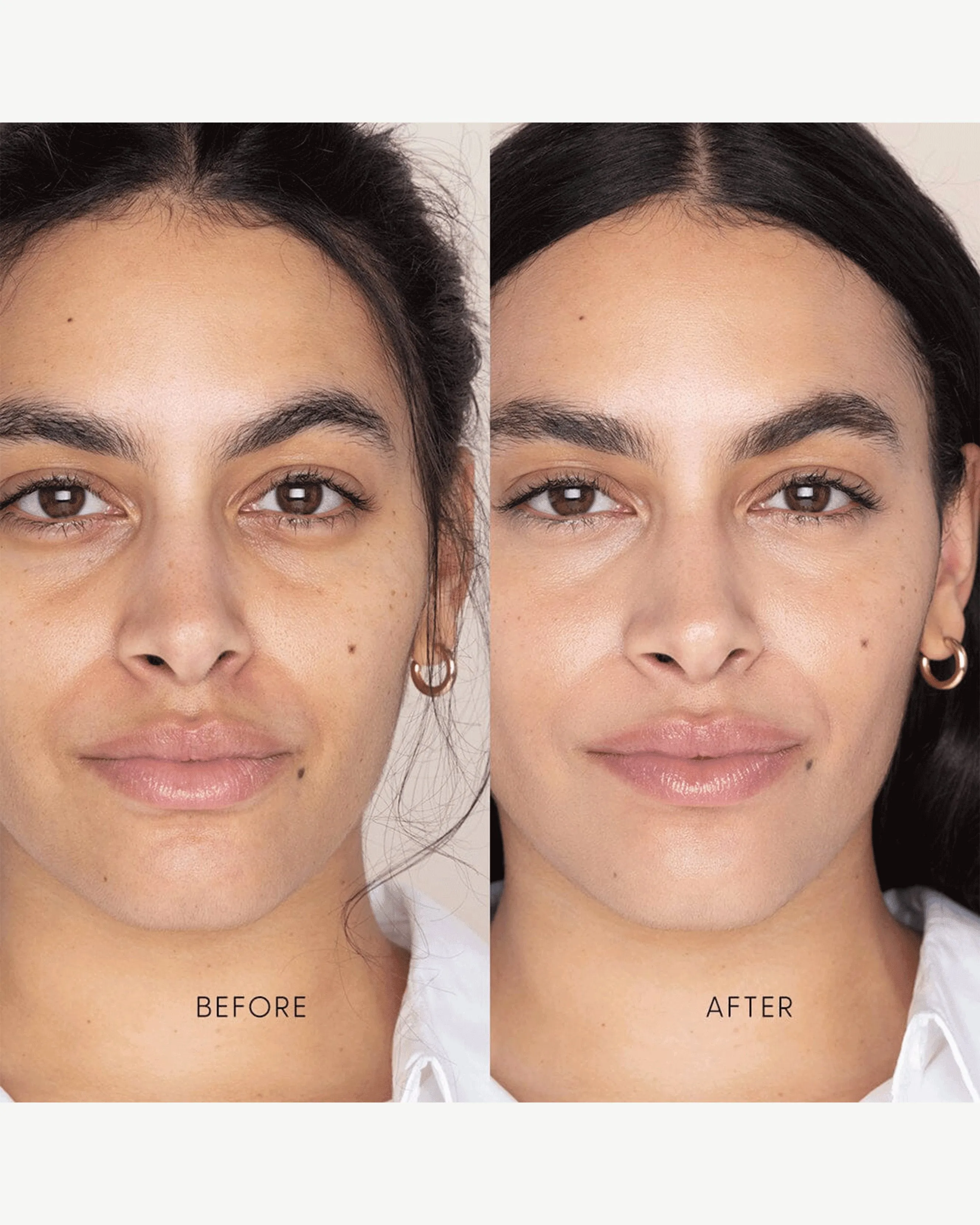 Best Skin Days Treatment Concealer