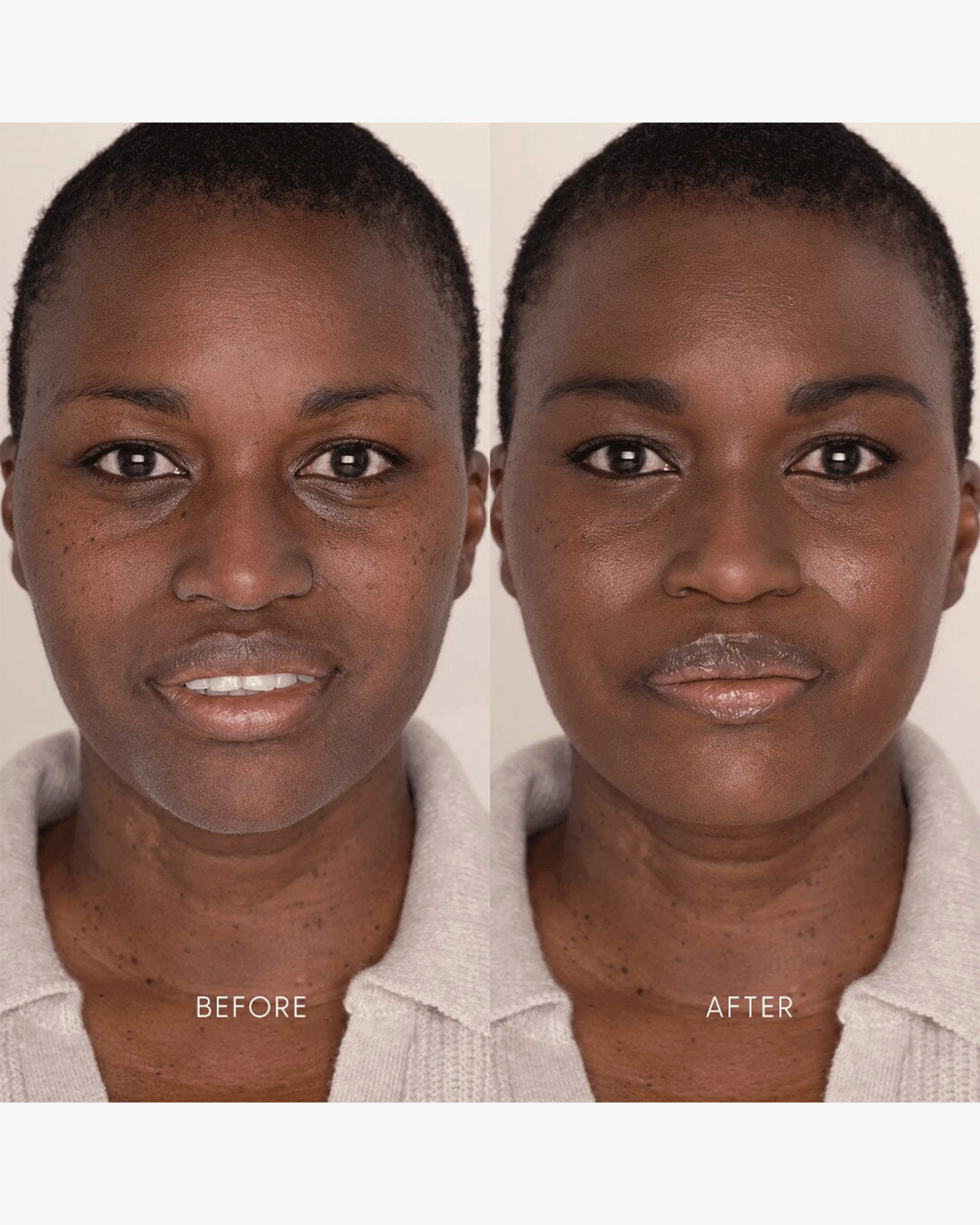Best Skin Days Treatment Concealer