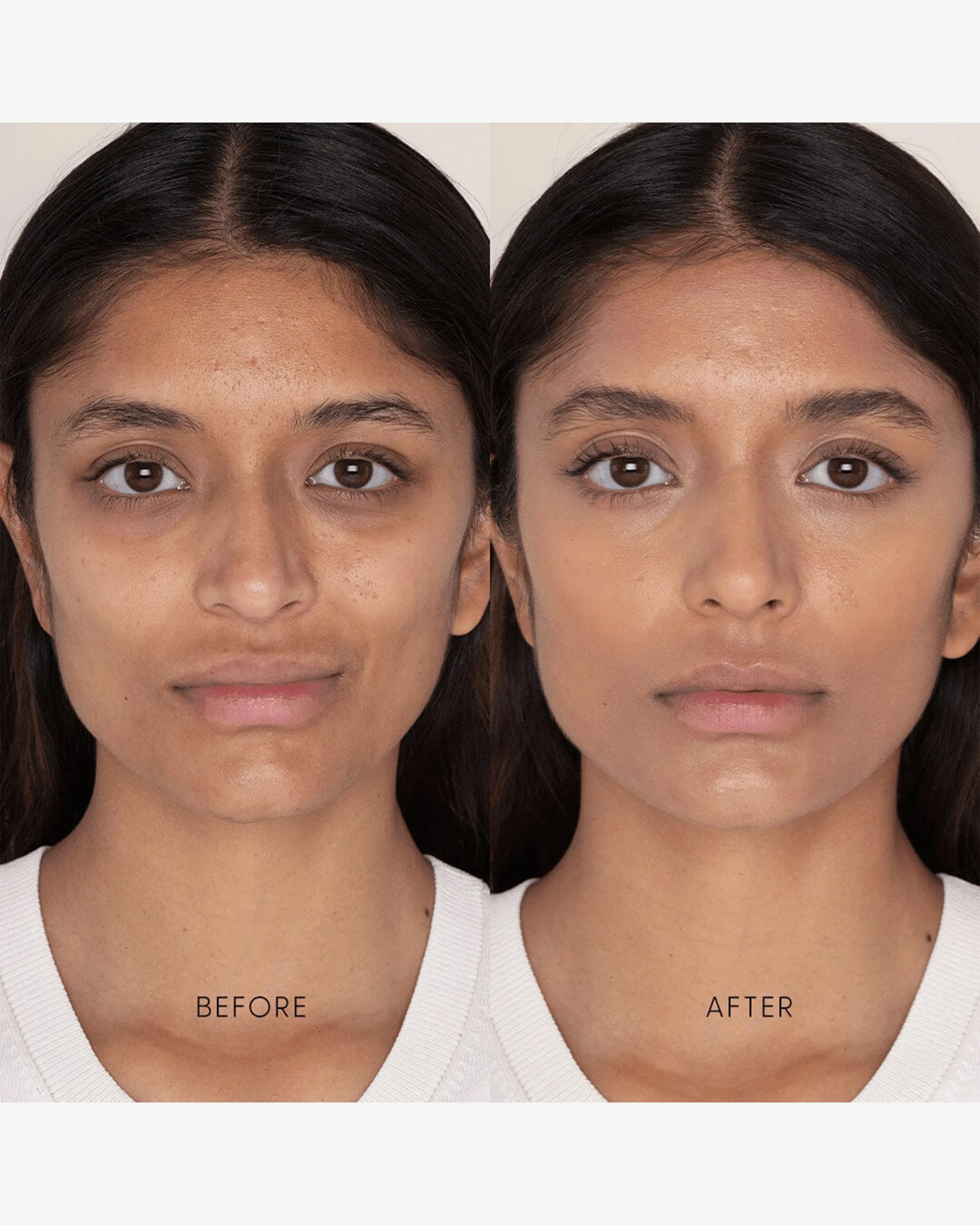 Best Skin Days Treatment Concealer