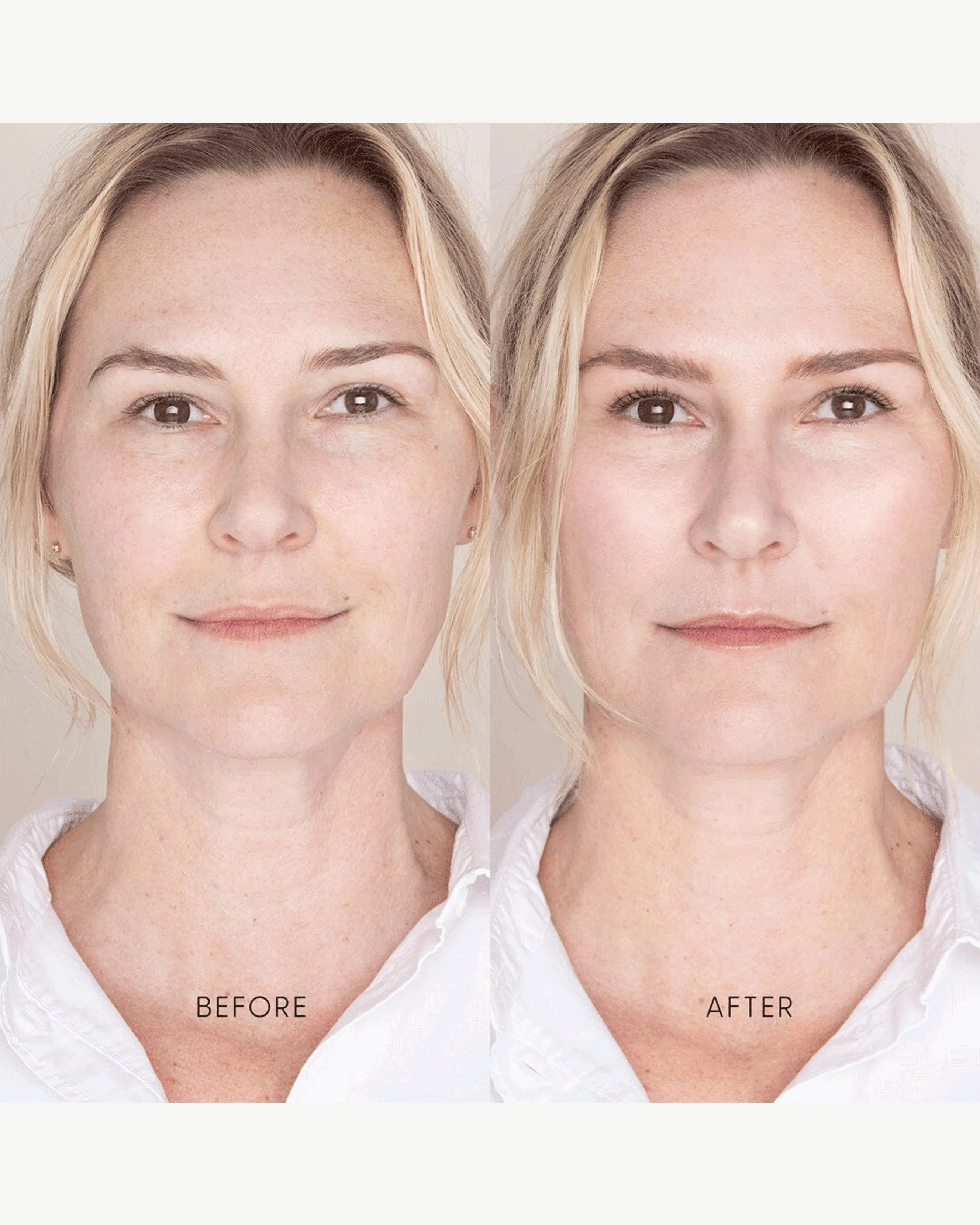 Best Skin Days Treatment Concealer