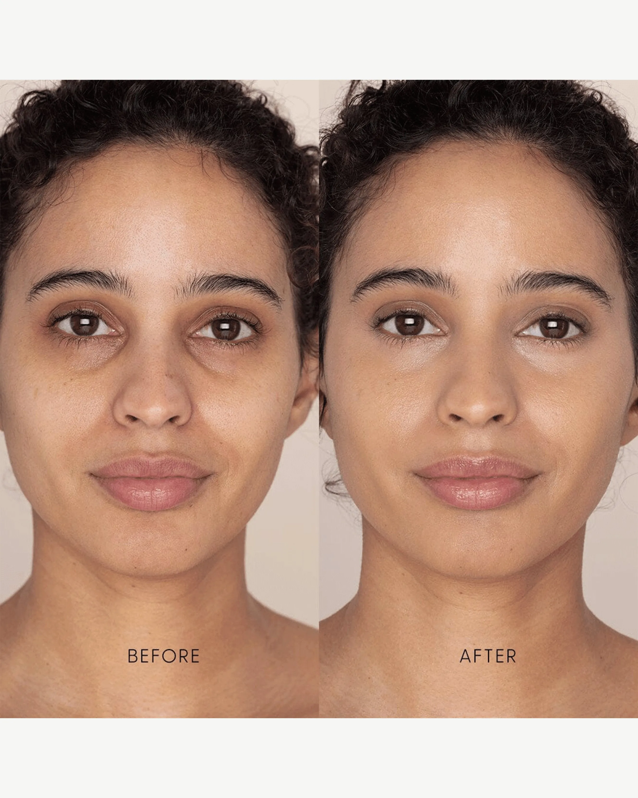 Best Skin Days Treatment Concealer