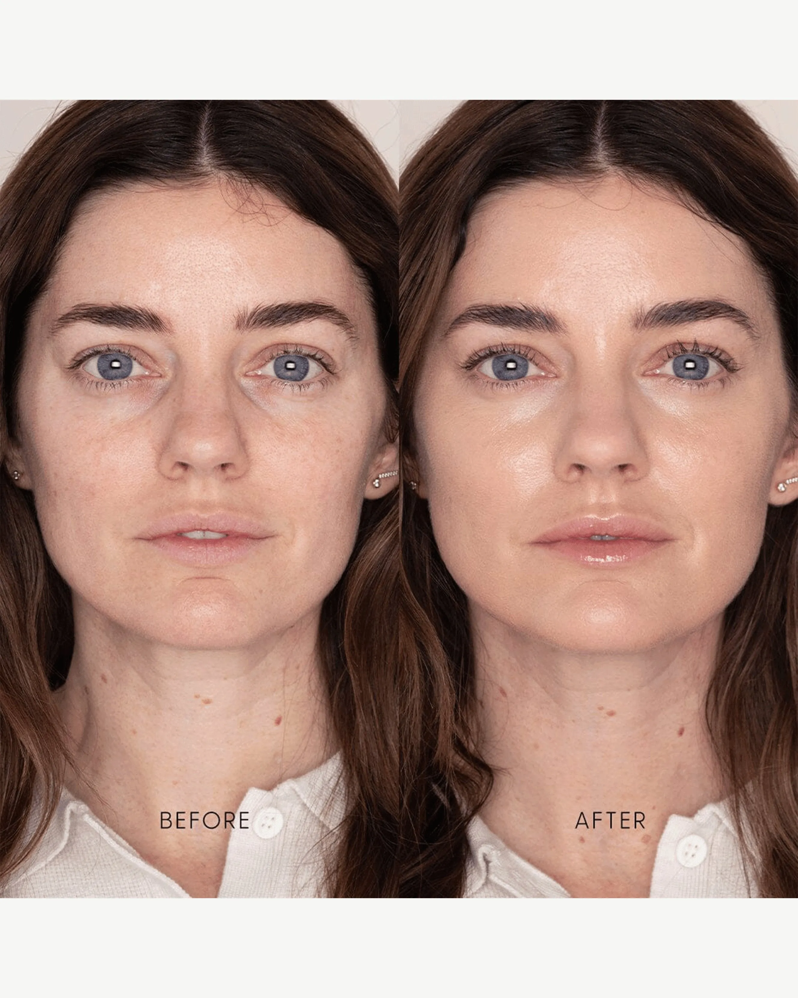 Best Skin Days Treatment Concealer