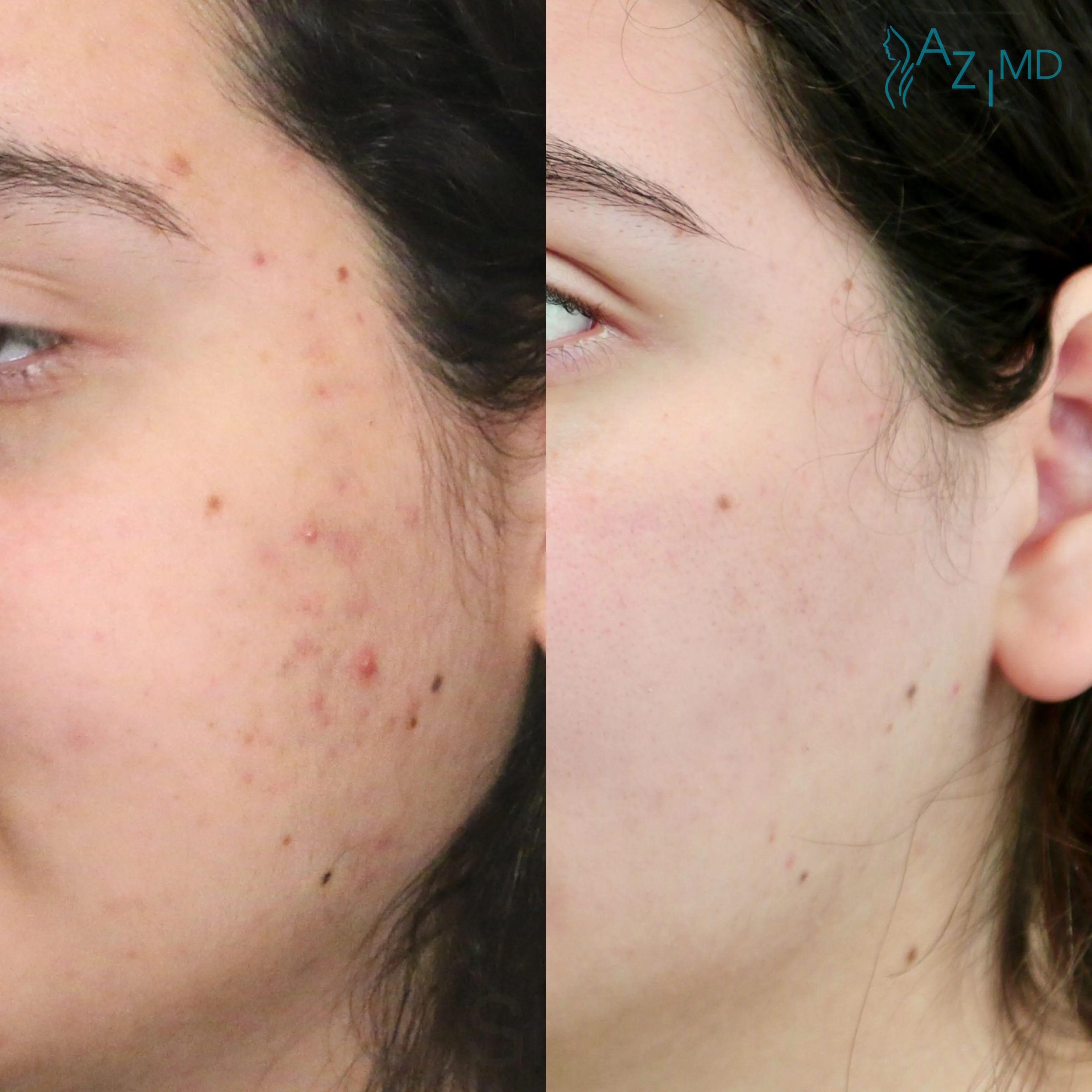 EXFOLIATING CLEANSER