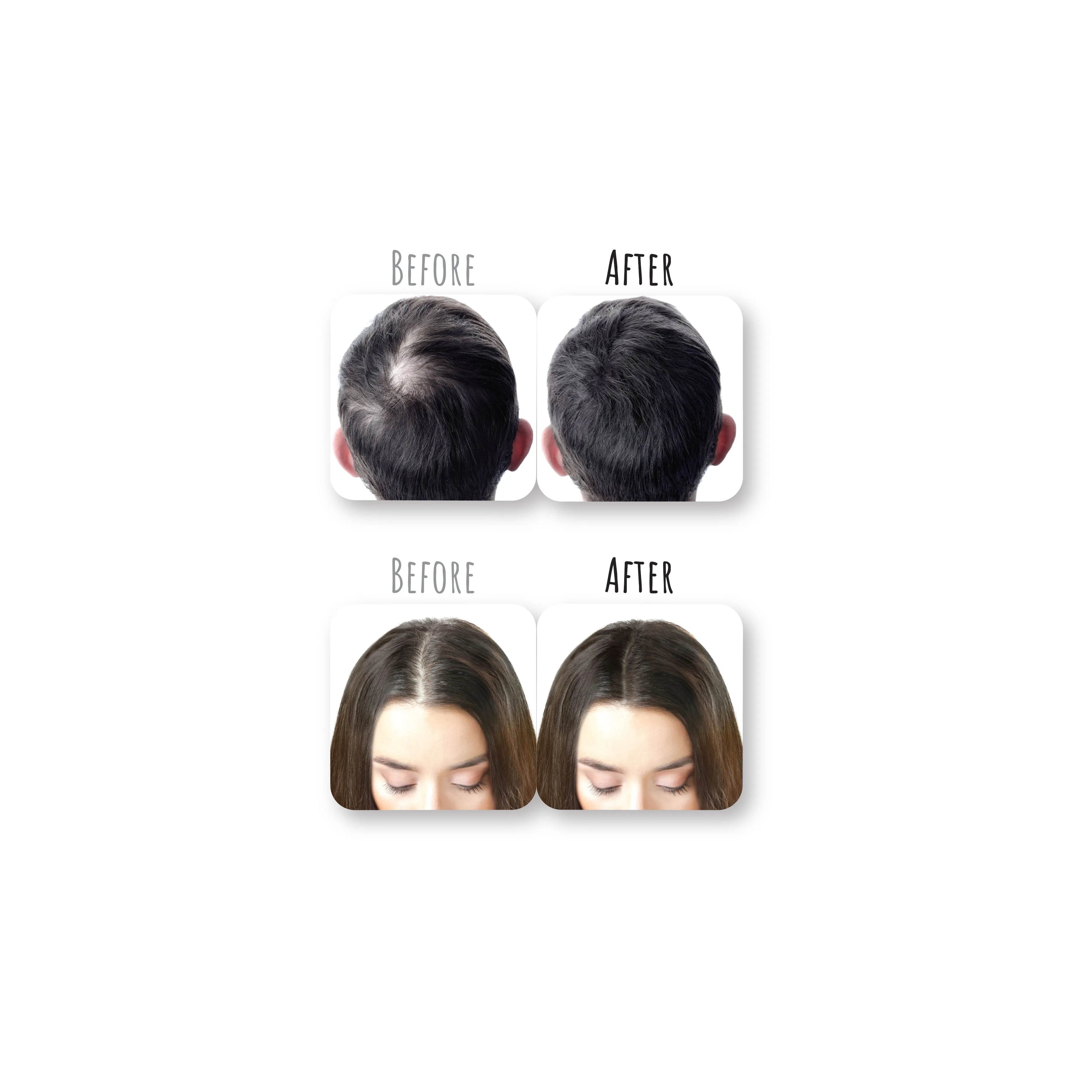 HAIR CONCEALER
