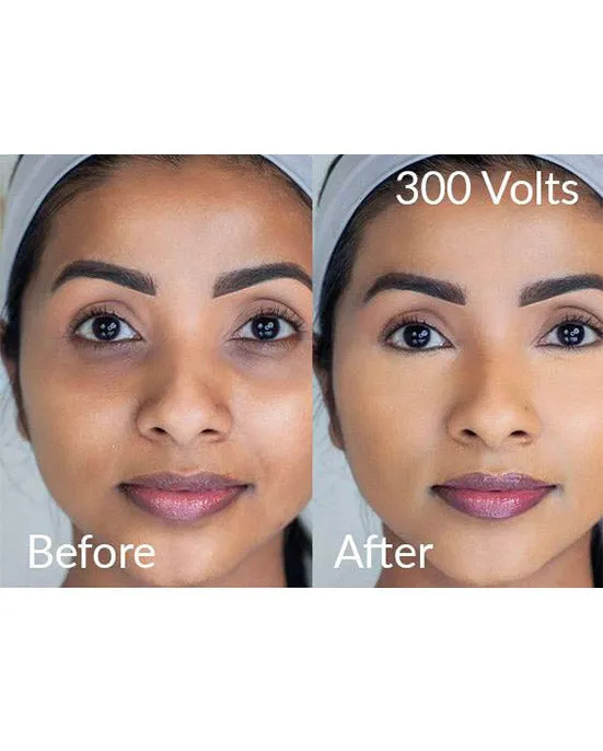 Lotus Brightening Powder - 300 Volts