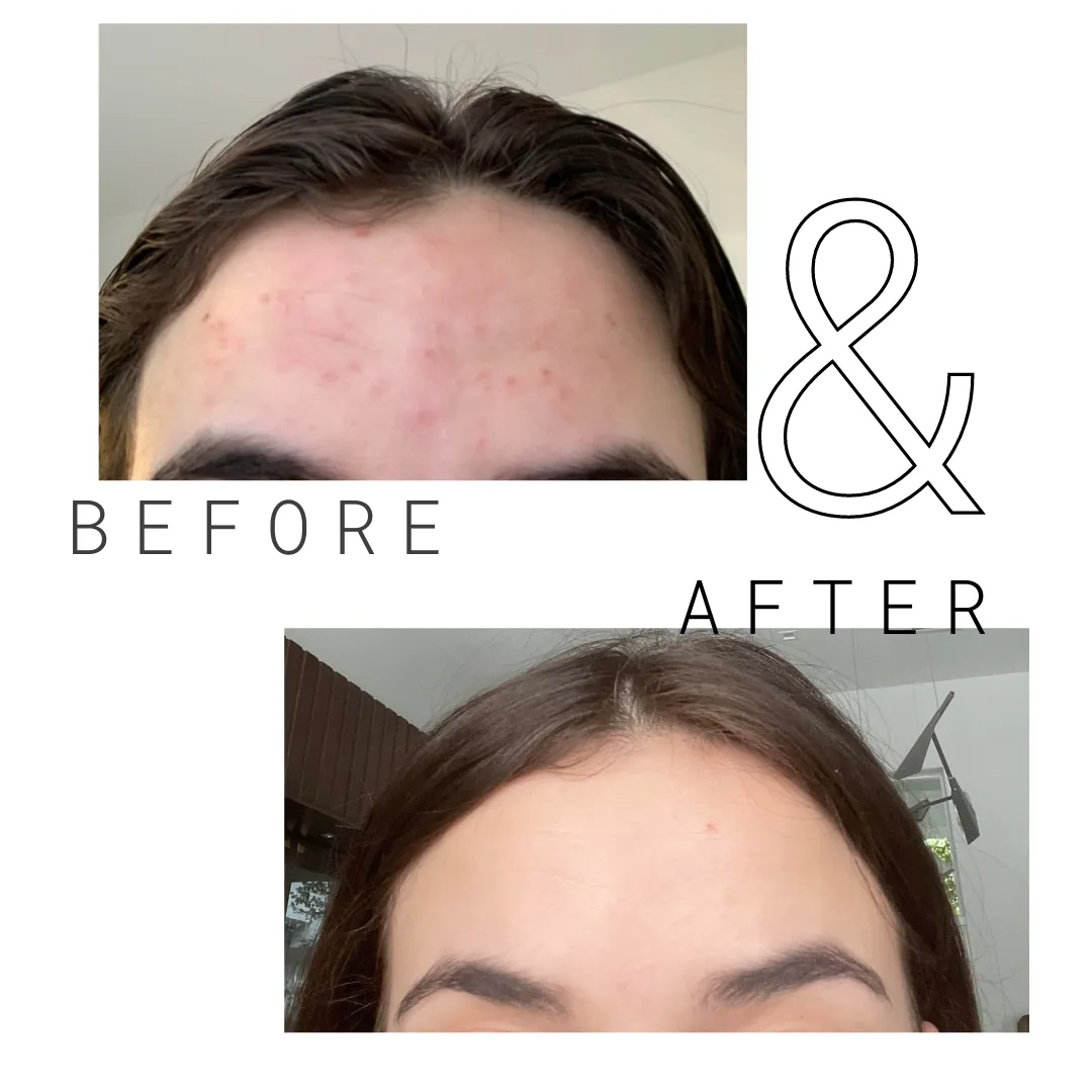 Yon-Ka SOS Spot Roll-On Blemish Treatment
